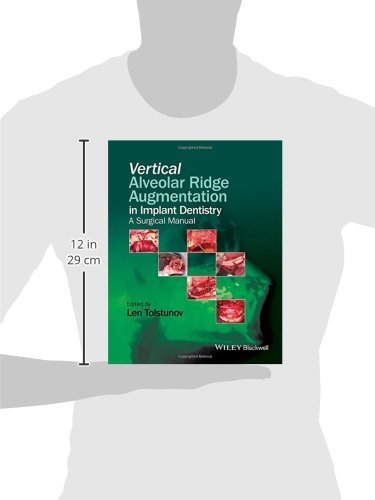 Vertical Alveolar Ridge Aug: A Surgical Manual