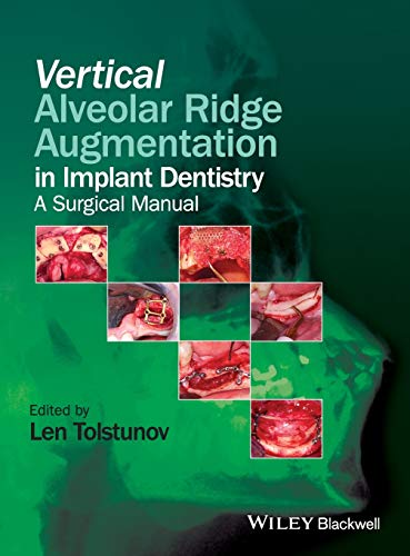 Vertical Alveolar Ridge Aug: A Surgical Manual