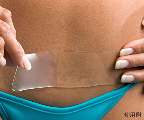 Biodermis Epidermis Natural Silicona Parches de Cicatriz 3 , 5x15cm Z. B. para Kaiserschnitt Lámina de Silicona contra Cicatrices Von Biodermis Silicone Pad Scars