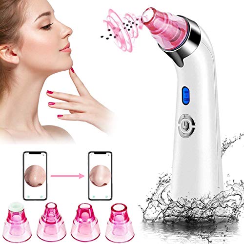 Limpiador de Poros Facial Removedor de Espinillas Eléctrico Con Indicador LED Succionador de Puntos Negros, Por USB, Con 5 Potencia de Succión Ajustable y 4 Sondas de Repuesto