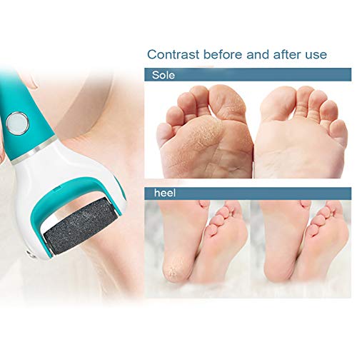 9 Piezas Lima Pies Scholl Velvet Smooth, 3 Tipos de Rugosidad, Dr Scholl Lima Electrica Pies, Doctor Scholl Lima Pedicura Electrico, Quita Durezas para Pies Electricole