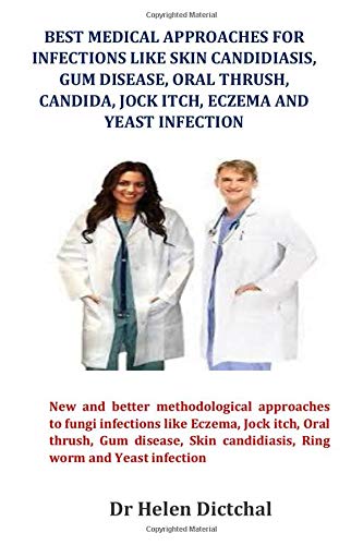 Best Medical Approaches for Infections Like Skin Candidiasis, Gum disease, Oral Thrush, Candida, Jock itch, Eczema and Yeast Infection