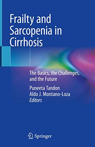 Frailty and Sarcopenia in Cirrhosis: A Personalized Approach