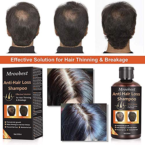 Hair Loss Shampoo, Champú Anticaida, Anti Pérdida De Cabello, esencia de hierbas naturales, promueve más cabello ticker, para suero de crecimiento rápido del cabello para hombres y mujeres