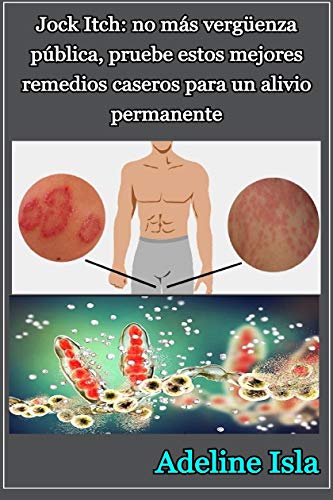 Jock Itch: no más vergüenza pública, pruebe estos mejores remedios caseros para un alivio permanente