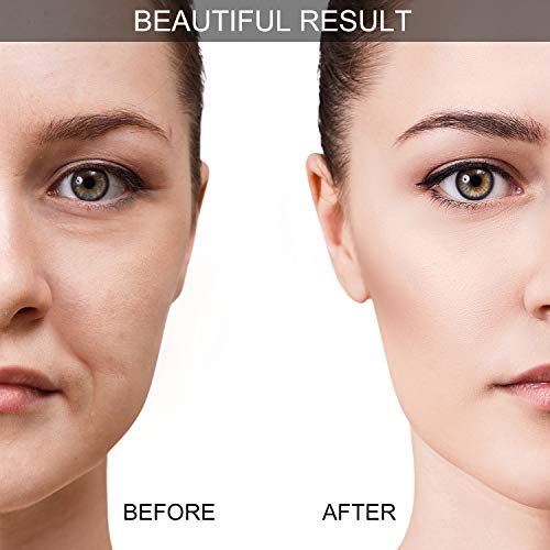 Juego de Ventosas Faciales Masaje Ahuecamiento de Cara y Ojos, Set de Ventosas Faciales Tazas de Silicona con Cepillo Exfoliante para Cara Cuello Piel (Pequeño Mediano Grande, Negro)