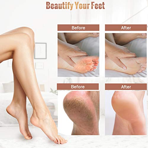 Lima Eléctrica Pies, Winpok Lima Eléctrica Pedicura Eléctrico Lima Pies Profesional Recargable Aparato de Pedicura eléctrico Eliminar Las Durezas y Las Callosidades Cuidado Pies con Recambios