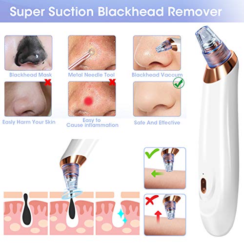 Limpiador de Poros, EIVOTOR Aspirador de Espinillas Puntos Negros Eléctrico USB Recargable Regalo 5 Kit Blackhead Remover 5 Cabezales y 3 Velocidad Potente para Eliminación de Espinillas y Acné