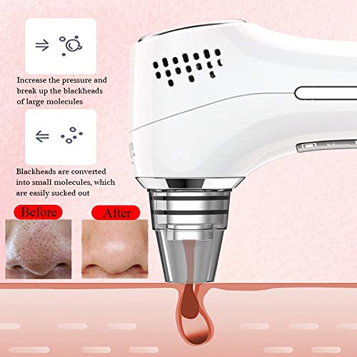 Noblik Aspiradora de Poros Blackhead Point Extractor EliminacióN de Espinillas Limpiador de Acné Facial Herramienta de Cuidado de la Piel Belleza Facial FríA y Caliente