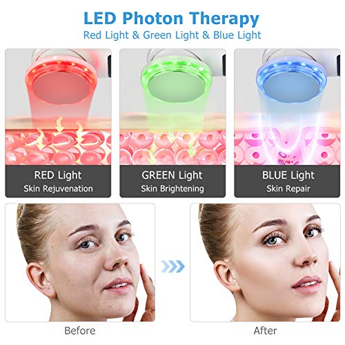 Ultrasonidos Instrumento De La Belleza Del Color Casa Cálida Luz De Iones Positivos Y Negativos Instrumento De Introducción De Vibraciones Cuidado Facial Instrumento De Masaje